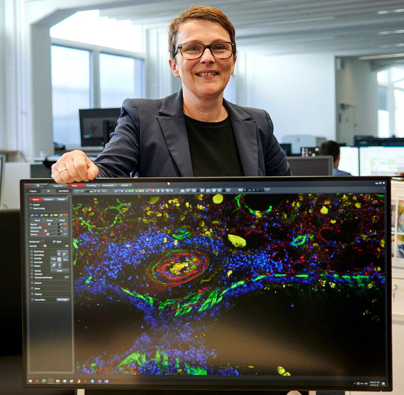 Dr. Annette Rinck an einem Monitor,  dem Teil eines Mikroskopsystems:  Zu sehen ist gefärbtes Lungengewebe einer Maus.